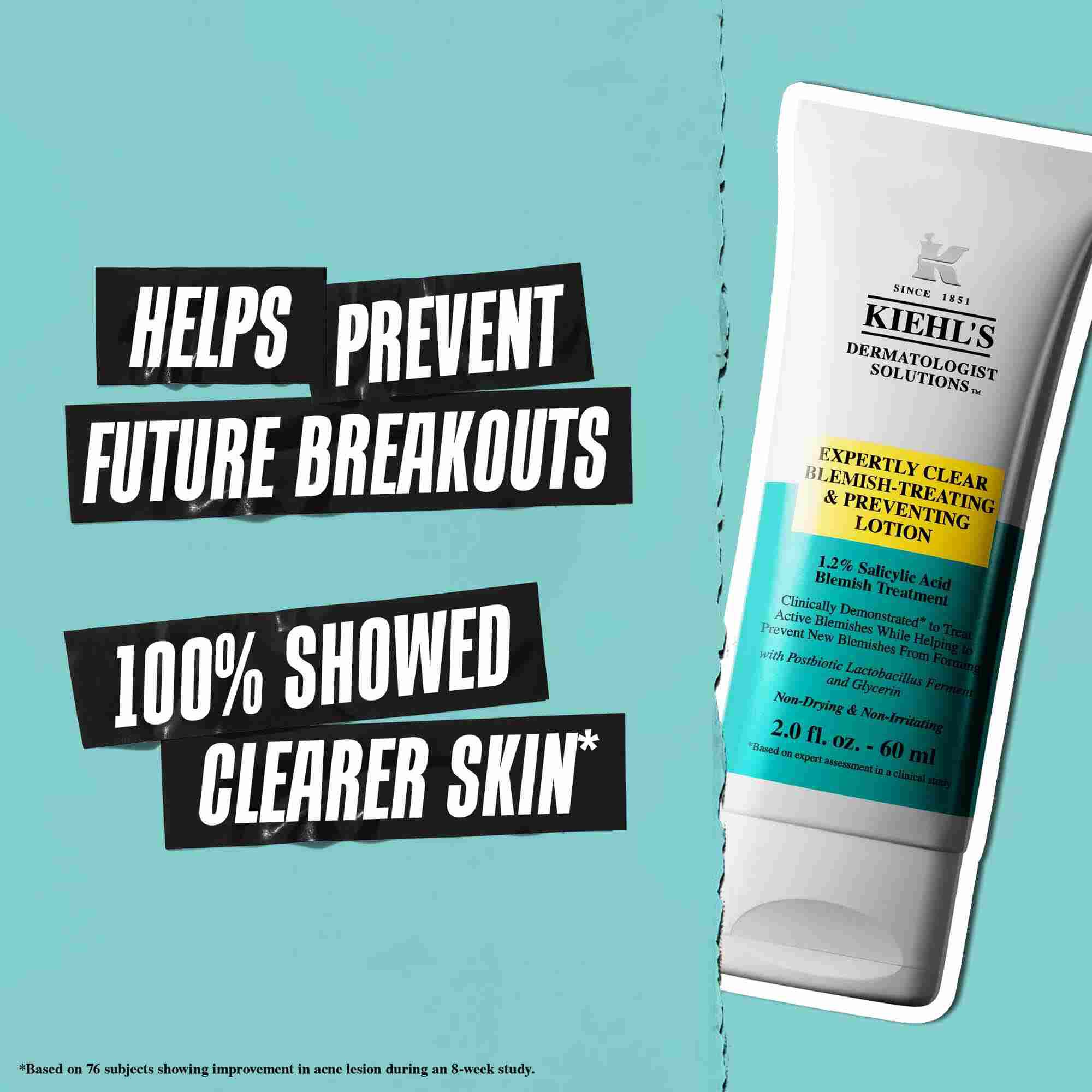Tuba Expertly Clear Blemish-Treating & Preventing Lotion na modrom pozadi s textom: „Pomaha predchadzať buducim vyražkam“ a „100 % preukazalo čistejšiu pleť.“