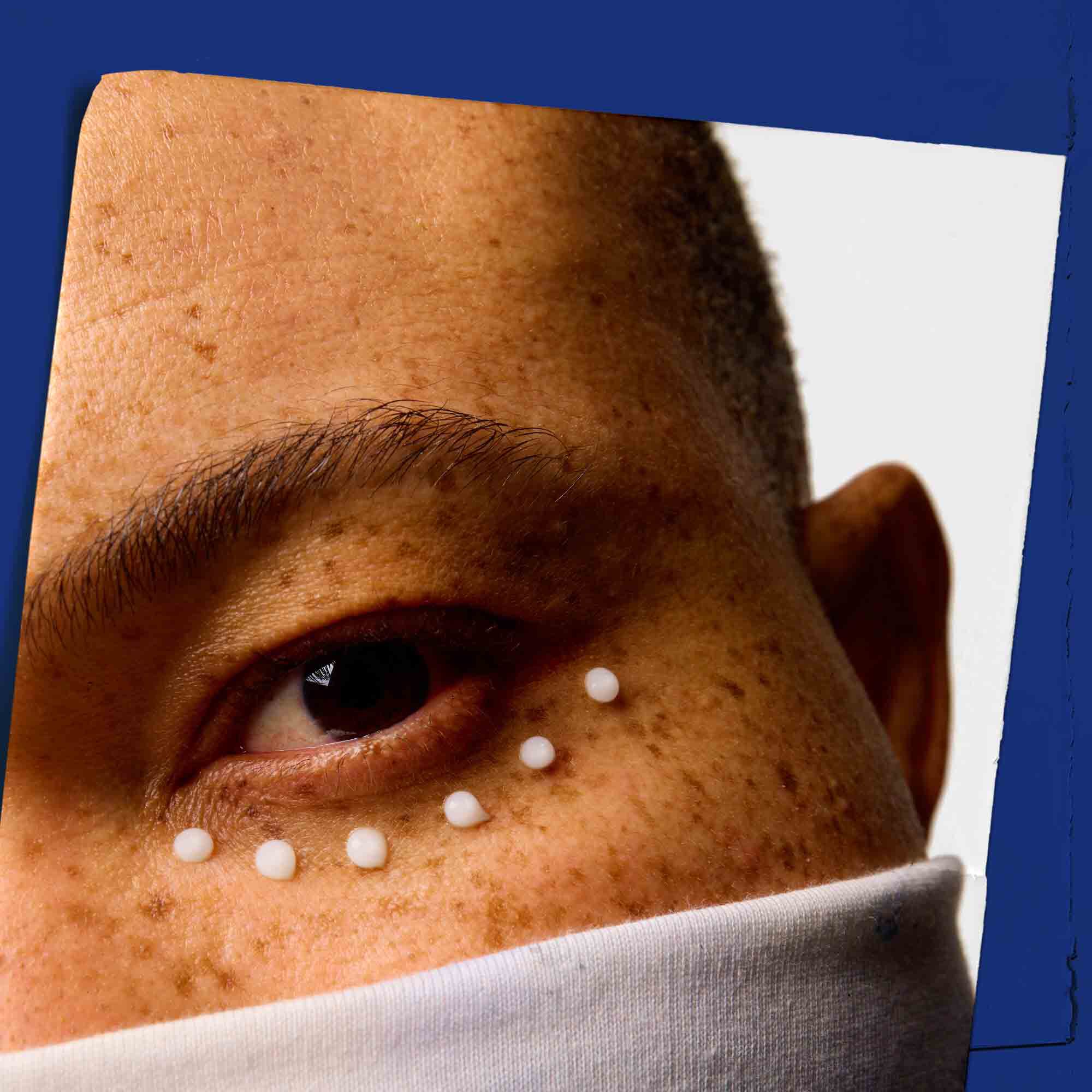 Detail pokožky okolo oči s nanesenym Facial Fuel Eye Fuel.