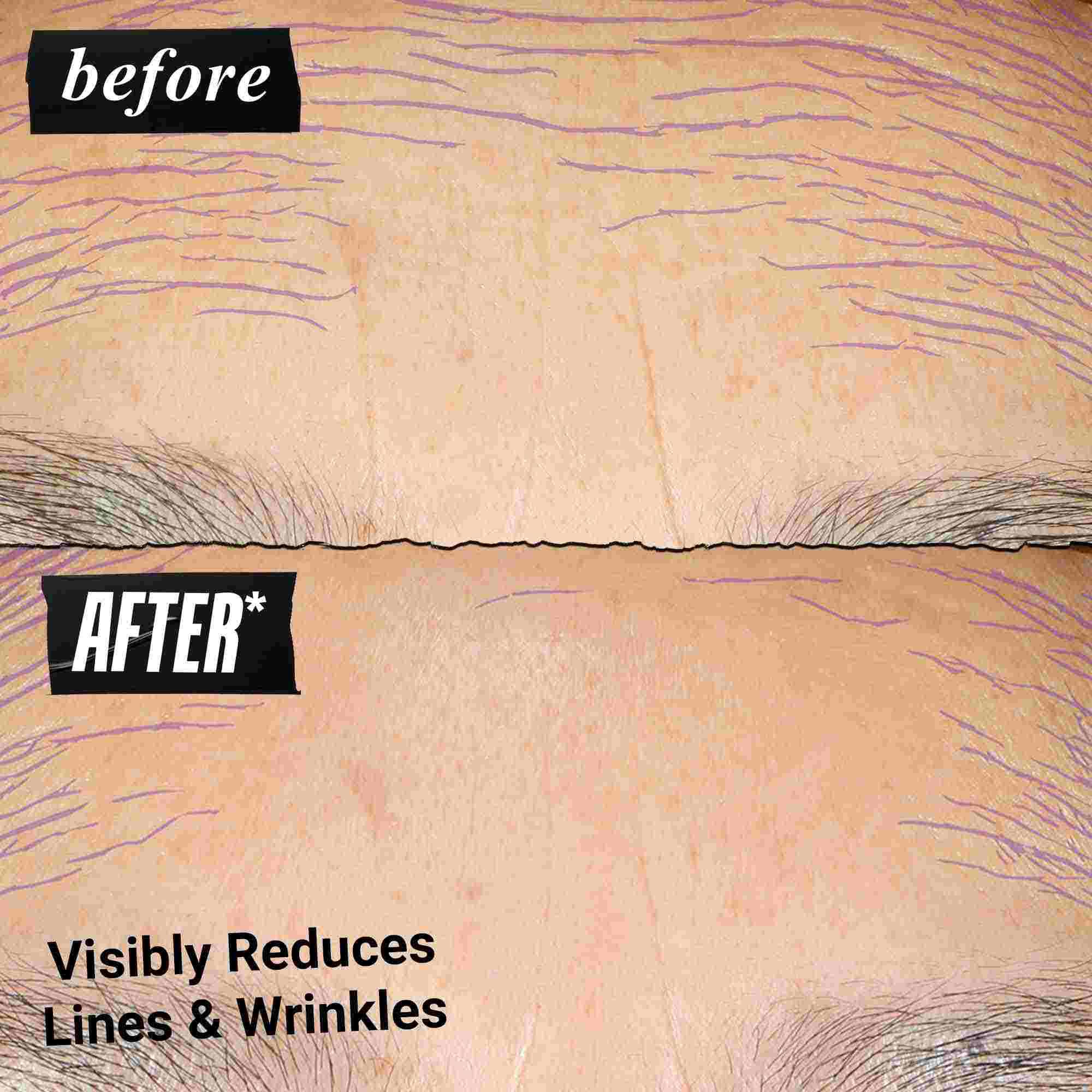 Fotografia „Pred a Po“ – Kiehl's Retinol Skin Renewing Daily Microdose pomaha zlepšiť ton a texturu pleti