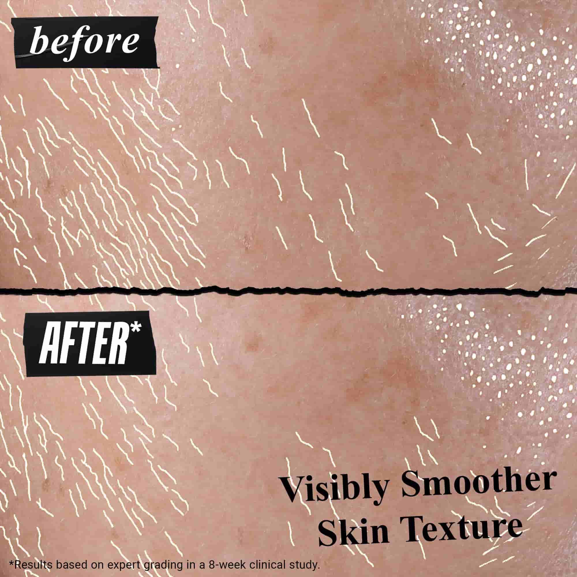 Vysledky pred a po použiti Better Screen UV Serum na pleti
