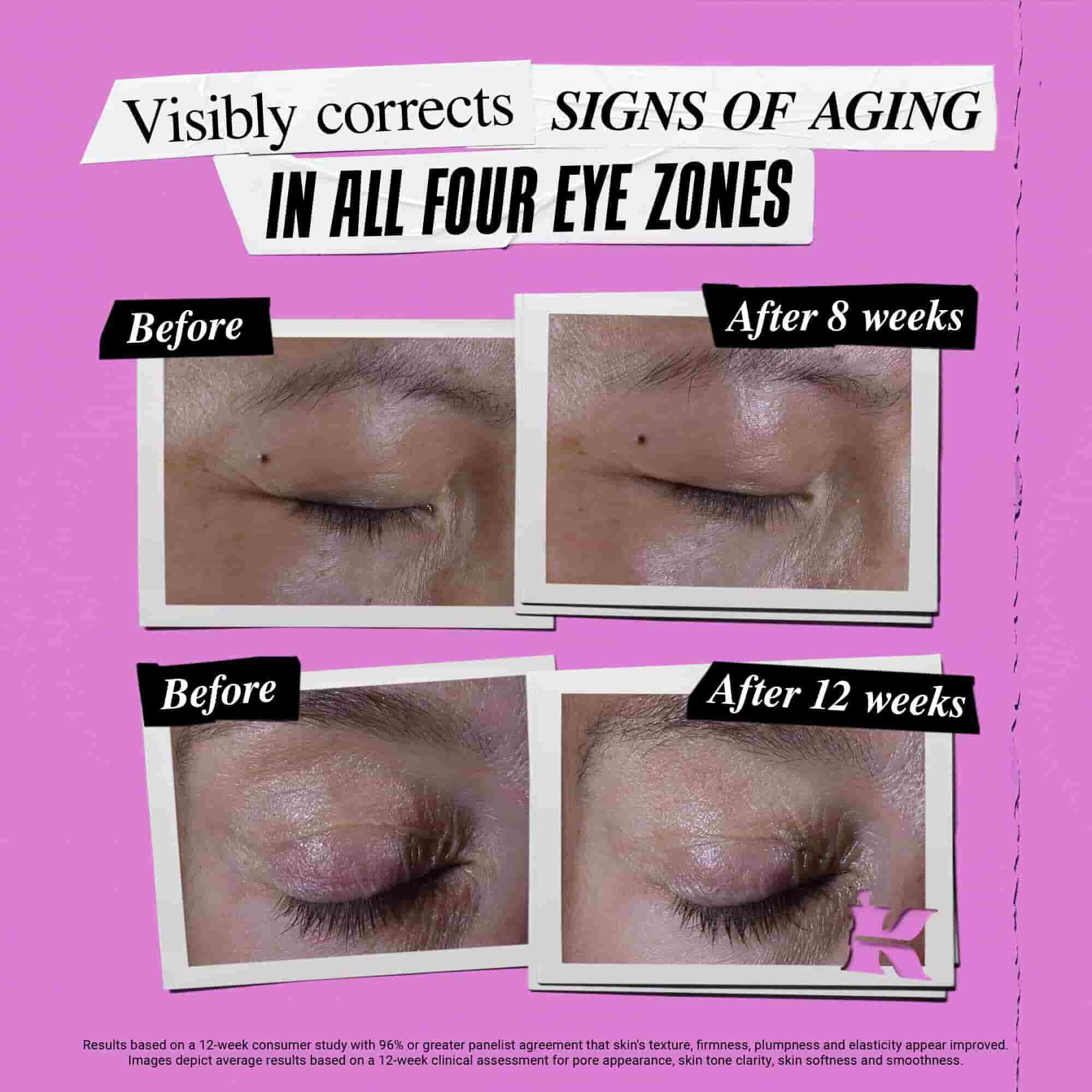 Fotografia „Pred a Po“ – krem Kiehl's Super Multi-Corrective Eye Zone Treatment koriguje znamky starnutia
