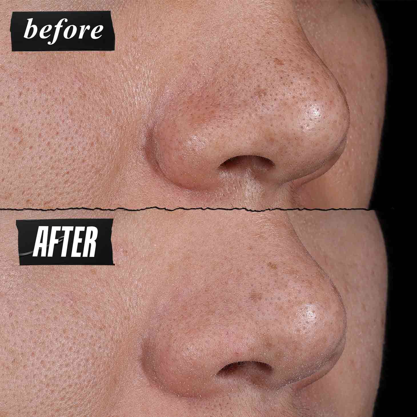 Fotografia „Pred a Po“ – hĺbkovo čistiaca maska Kiehl's Rare Earth viditeľne sťahuje pory