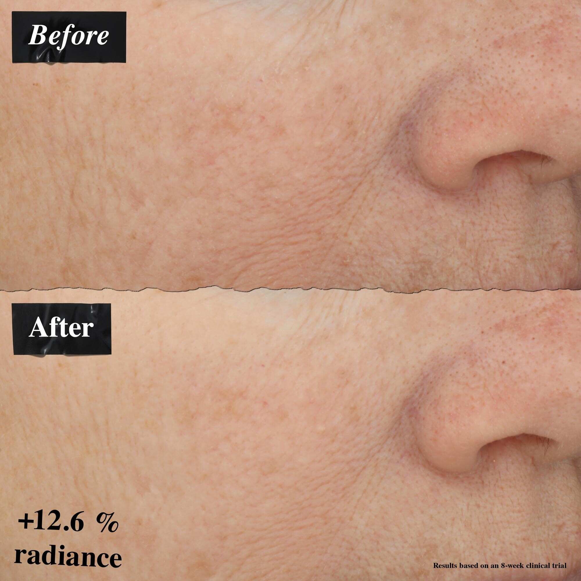 Porovnanie obrazkov pred a po ukazujuce zlepšenie začervenania pleti po použiti Powerful-Strength Line-Reducing Concentrate.