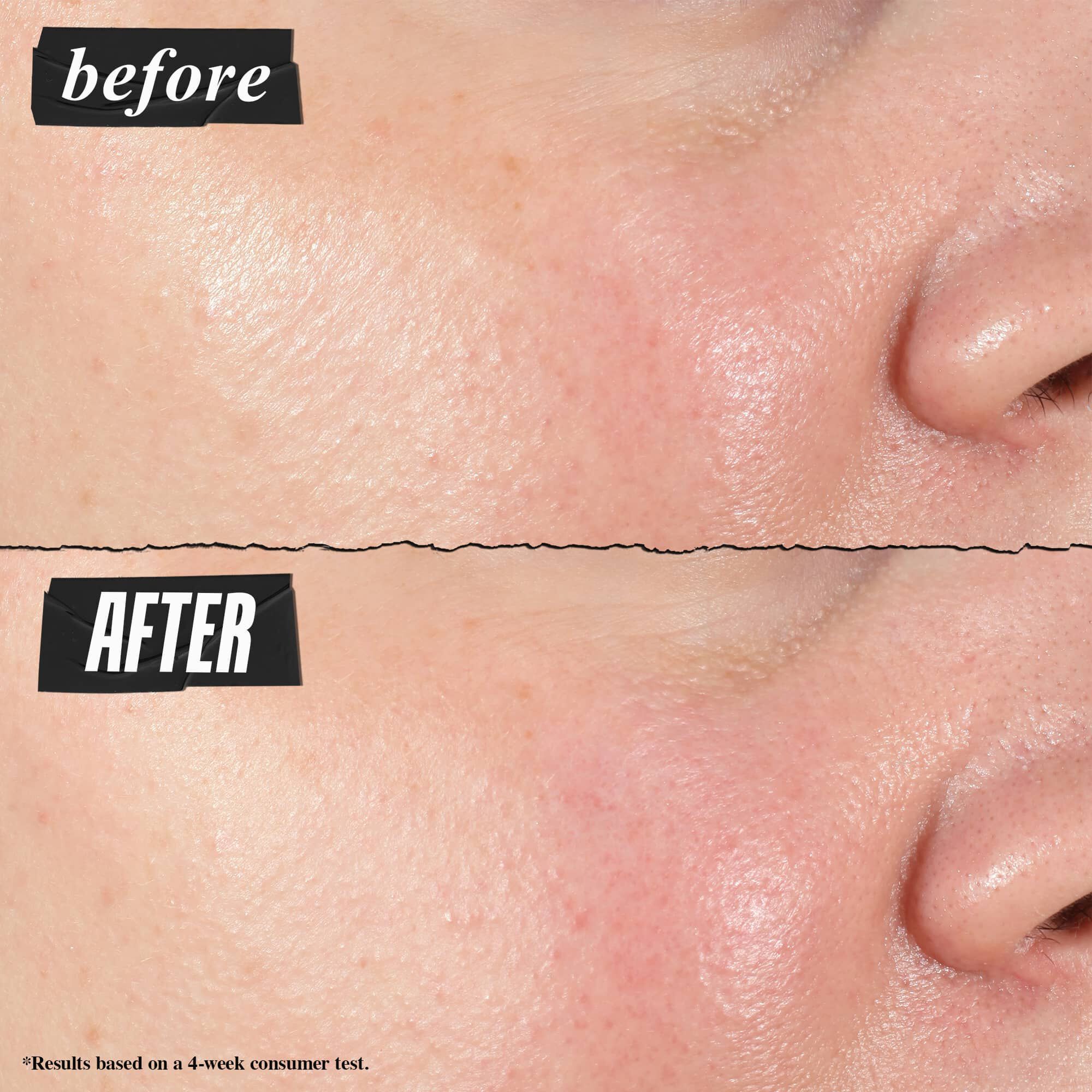 Fotografia „Pred a Po“ – Kiehl's Hydro Plumping Serum Concentrate viditeľne sťahuje pory