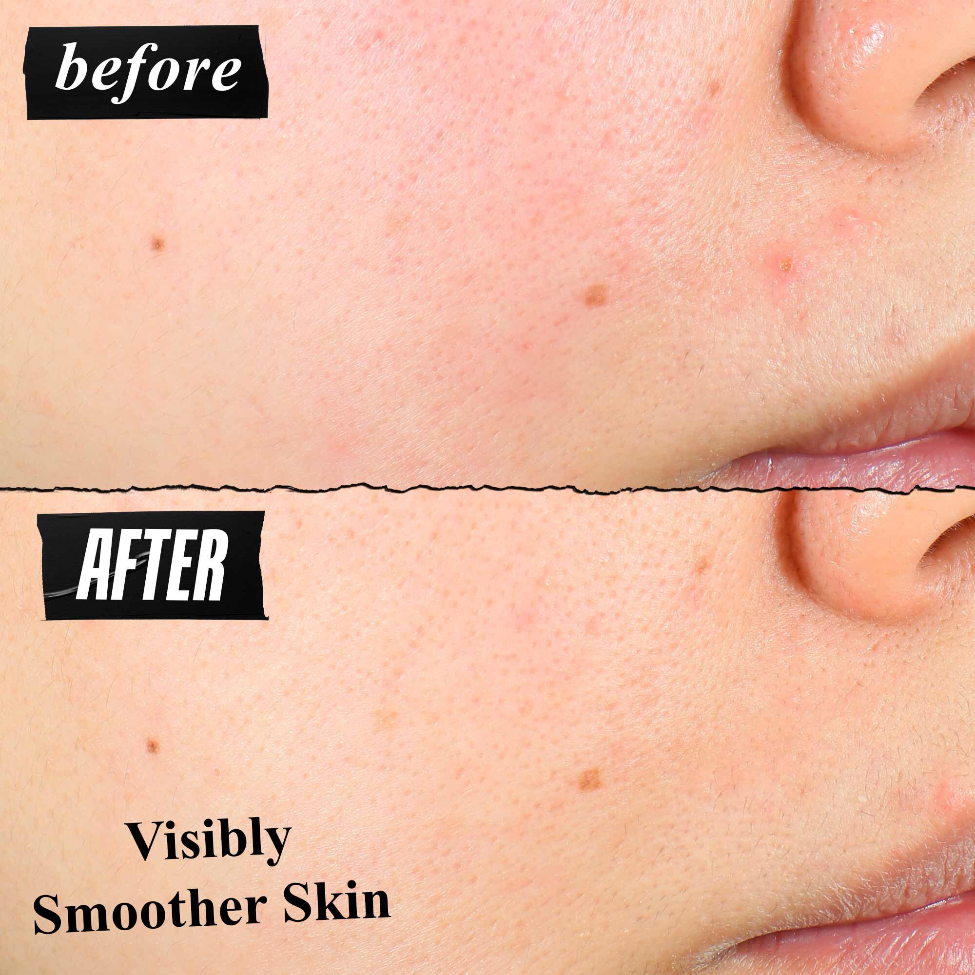 Porovnanie textury pleti pred a po, ukazujuce viditeľne hladšiu pleť po použiti.