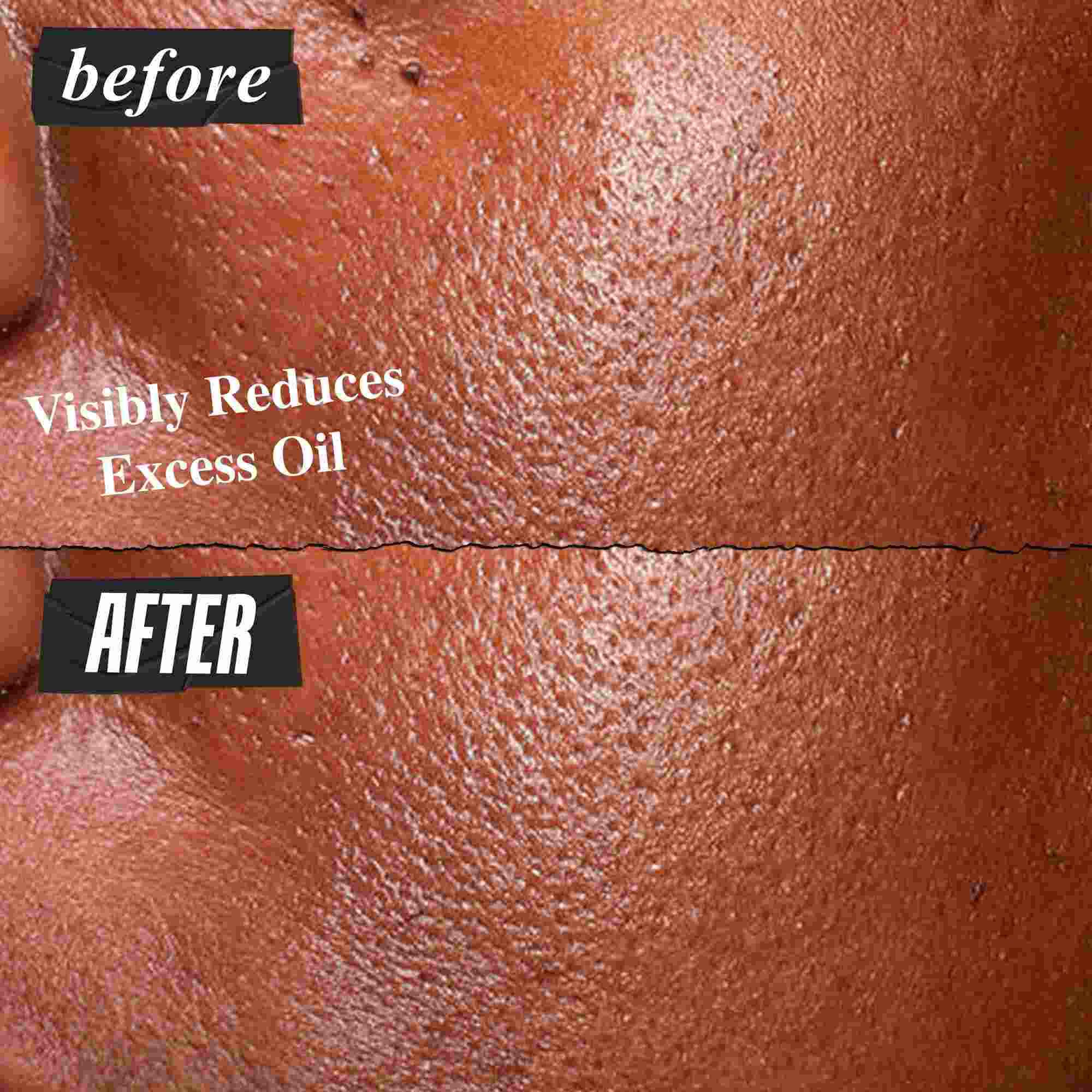 Fotografia „Pred a Po“ – serum Kiehl's Ultra Pure High-Potency Serum viditeľne redukuje nadbytočny maz