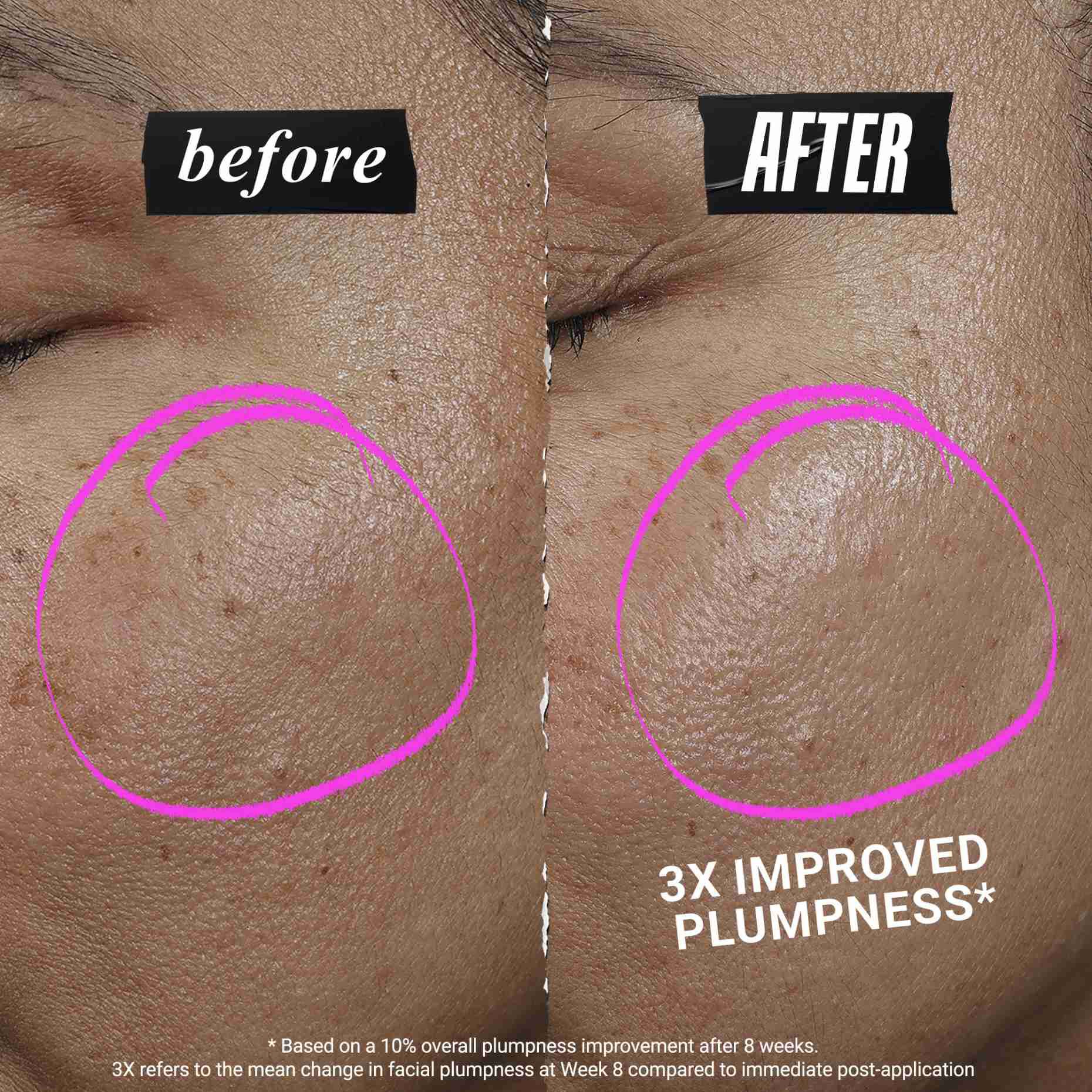 1cc* CollaShot Plump Serum, kolagenove pleťove serum pre vyplnenu a spevnenu pleť