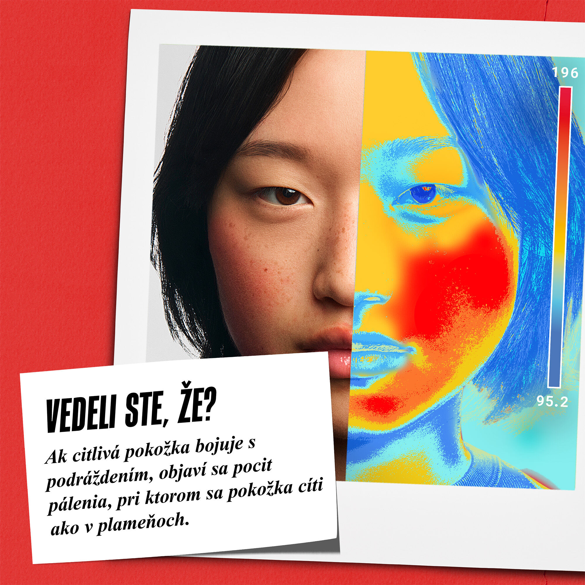 Vedeli ste? Keď je citliva pleť zapalena, vyvolava pocit palenia, kvoli ktoremu mate pocit, akoby vaša pleť bola v plameňoch.