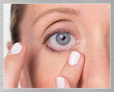 A close-up of a person’s eye, showing a blue iris and the surrounding skin. The individual is using their finger to gently touch the skin near their eye. Their nails are painted white.