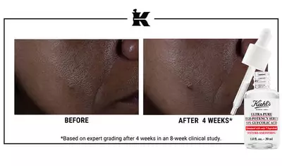 Before and after comparison of skin texture, showing improvement after four weeks of using Kiehl's Ultra Pure Glycolic Acid serum, with a dropper bottle of the serum featured in the image.